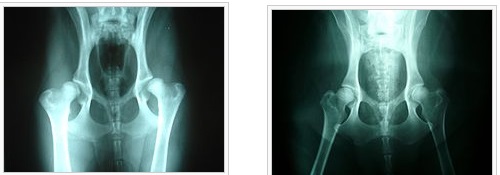 FHO hip dysplasia