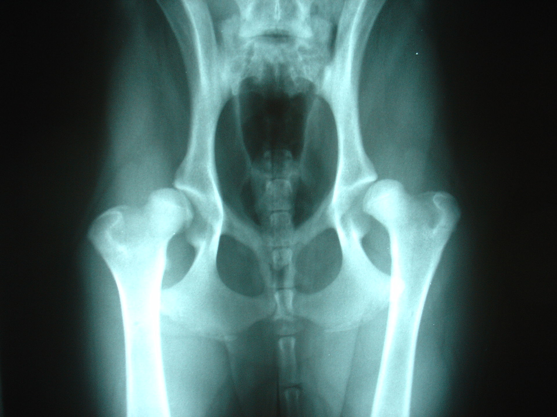 FHO hip dysplasia