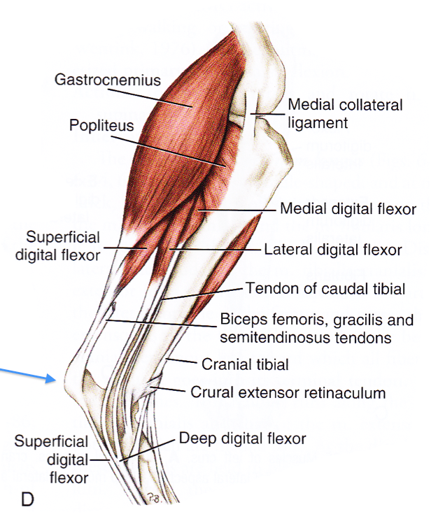 tendon repair