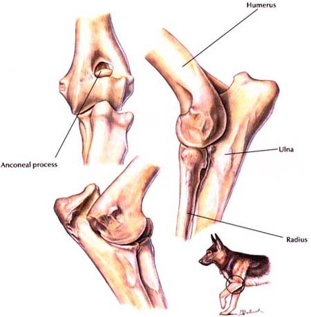 Ulna or Radius Ostectomy