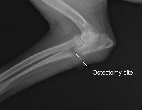 ulnar ostectomy